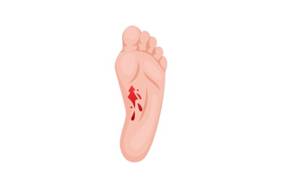 Download Open Laceration on Heel, Lower Part of F - Lower Collection